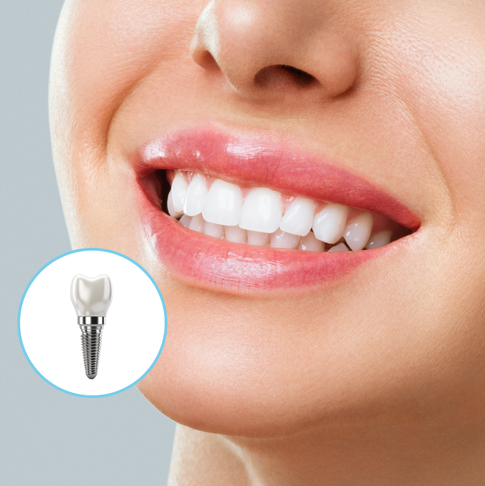 Our New York Implant Affiliate Centers